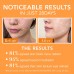 Proya Elastic Brightening Youth Essence 30ml 珀莱雅弹润透亮青春精华液