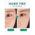 Mentholatum Acne Scar Reducing Gel 18g 曼秀雷敦乐肤洁痘痕淡化啫喱