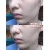HBN Yeast Moisturizing Firming Mask 5PCS HBN酵母水光嫩肤面膜
