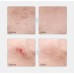 3M Artificial Skin Acne Patch Invisible Repair Waterproof 10*10cm 3M人工皮痘痘贴隐形修复防水